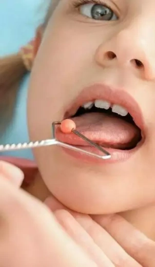 ЛОГОПЕДИЧЕСКИЙ МАССАЖ